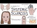 Systemic sclerosis and scleroderma visual explanation for students