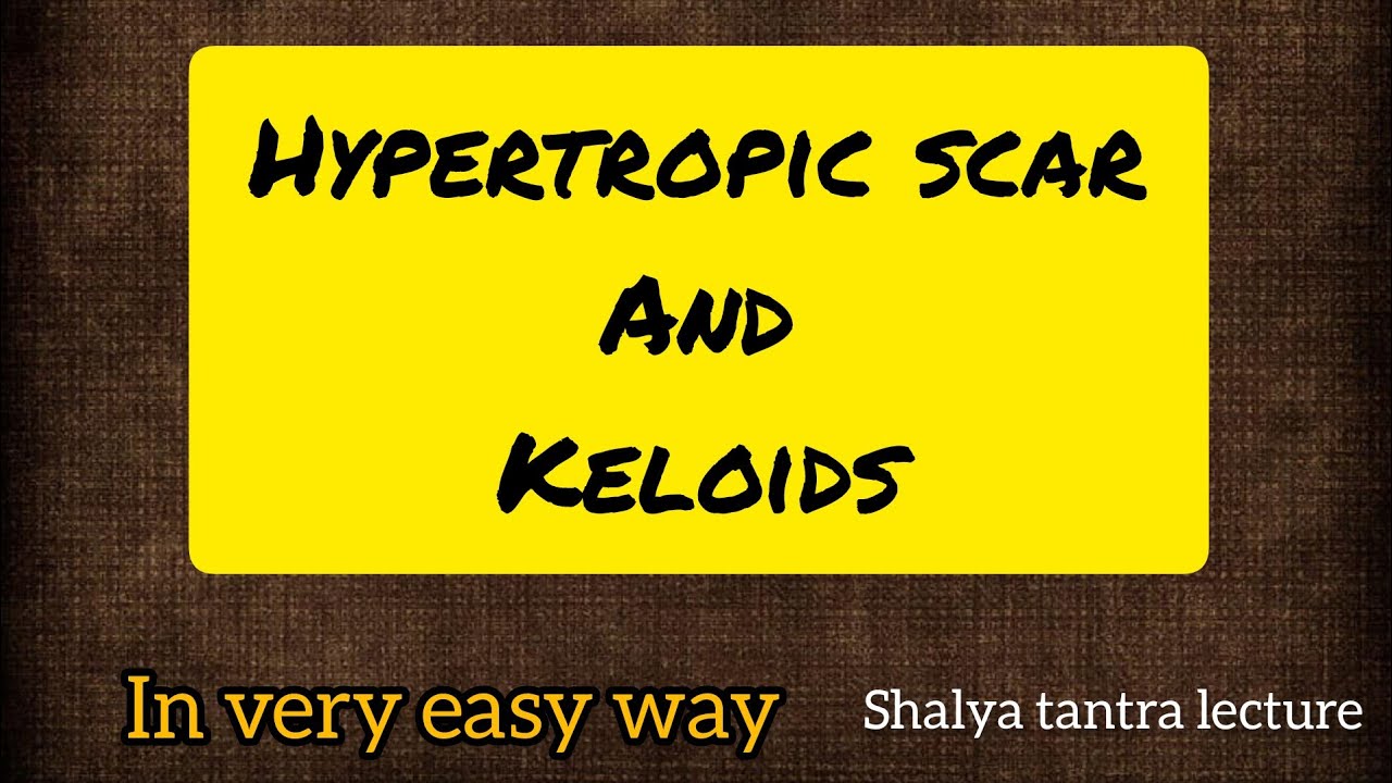 Hypertrophic scar and keloids shalya tantra in very easy way 