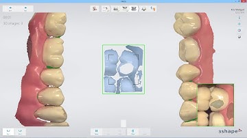 3Shape TRIOS - Dentrix-TRIOS Workflow JP