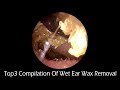 Top3 Compilation Of Wet Ear Wax Removal With Natural Mountain Background