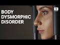 Body Dysmorphic Disorder Patients Actually See Faces Differently 