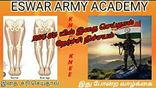 ssc gd constable medical problem / how to clear the knock knee problem