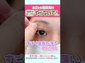 【20年後を見据えた整形】まぶたの脂肪取りをお勧めしない理由　#shorts