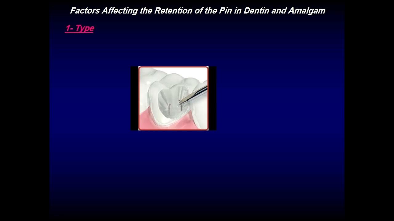 Pin retained amalgam restoration YouTube