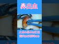 鼻出血の止血 #shorts