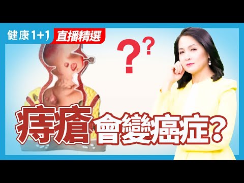 痔疮会变癌症？