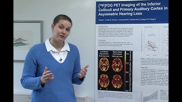 High-Resolution PET/CT Imaging Assesses Brain Stem Function in Patients with Hearing Impairment