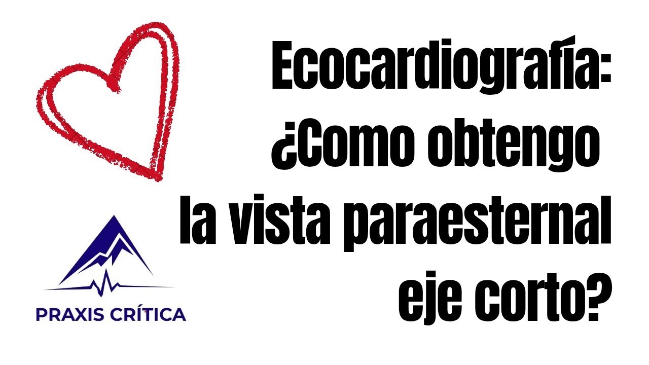 Ecocardiografía 2: ¿Como obtener la vista paraesternal de eje corto?