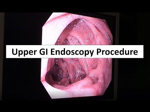 Upper GI Endoscopy Procedure in the ED