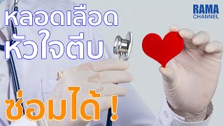 หลอดเลือดหัวใจตีบ ซ่อมได้ !