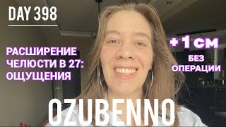 видео: БЕЗ БРЕКЕТОВ день 398: ощущения в начале лечения на аппарате Планас картинка: БЕЗ БРЕКЕТОВ день 398: ощущения в начале лечения на аппарате Планас