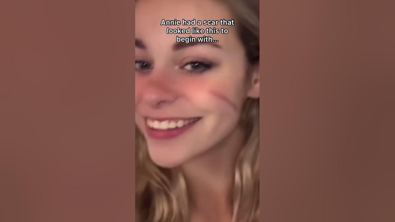 scargirl  - YouTube