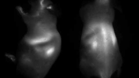 Deep tissue anatomical imaging of mice with carbon nanotube fluorophores in NIR II