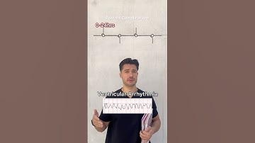 Post-MI Complications made easy🫀⏰#medstudent #medschool #usmle #usmlestep1 #usmlestep2 #cardiology