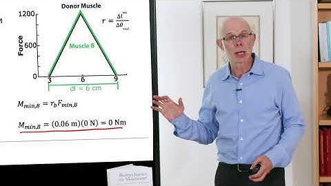 Biomechanics of Movement | Lecture 6.3: Using Musculoskeletal Geometry to Design Surgeries