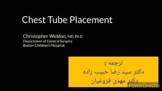 چست تیوب گذاری: نکات مهم در حین  گذاشتن chest tube