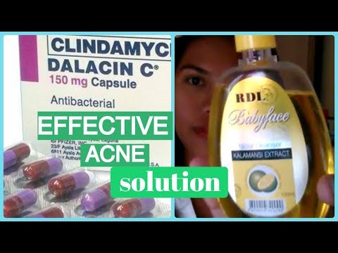 DALACIN C FOR ACNE, DARK SPOTS , HIGHLY EFFECTIVE ACNE/PIMPLE SOLUTION -| Helmz Jordan