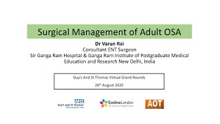 Head & Neck | Surgical Management of Adult OSA | Dr Varun Rai screenshot 5