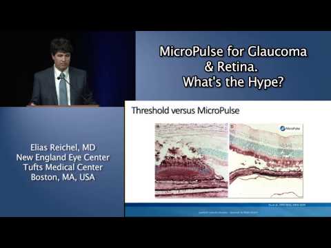 MicroPulse for Glaucoma & Retina. What&rsquo;s the Hype?