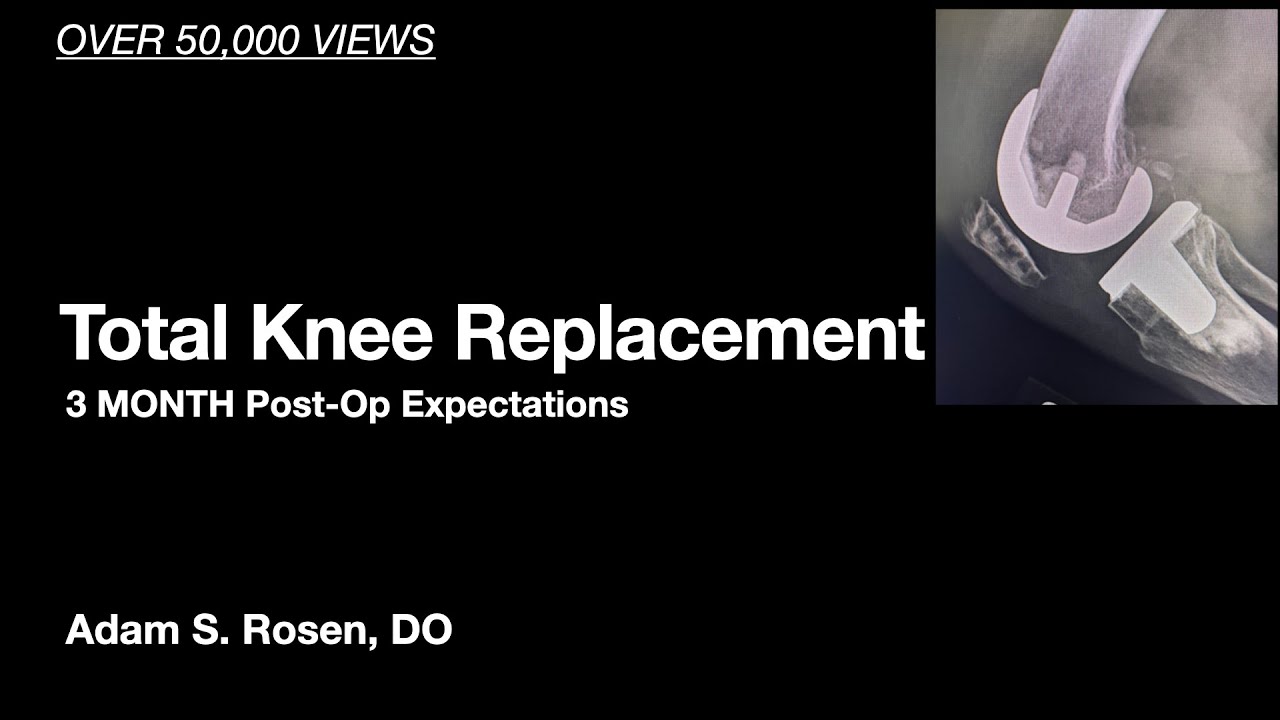 can you travel 3 months after knee replacement