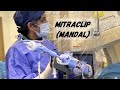 Mitral Clip (Mandallama: MitraClip)