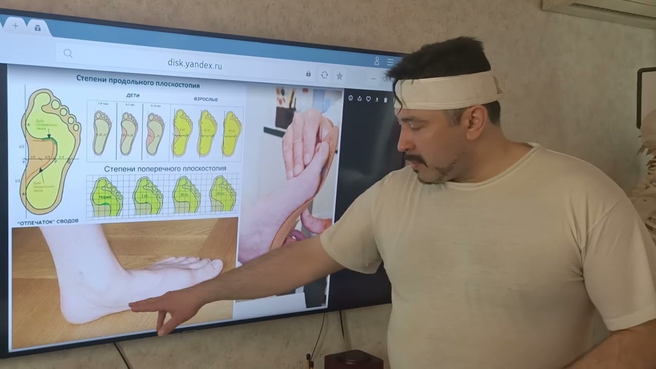 Как исправить плоскостопие - секреты от Мануального терапевта Олега ...