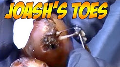 Joash's Jiggers!  Part One 👍😷😍😡💉 