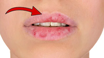 Was spendet den Lippen Feuchtigkeit?