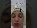 جمال ألفا حصلاتو مرتو بالدليل