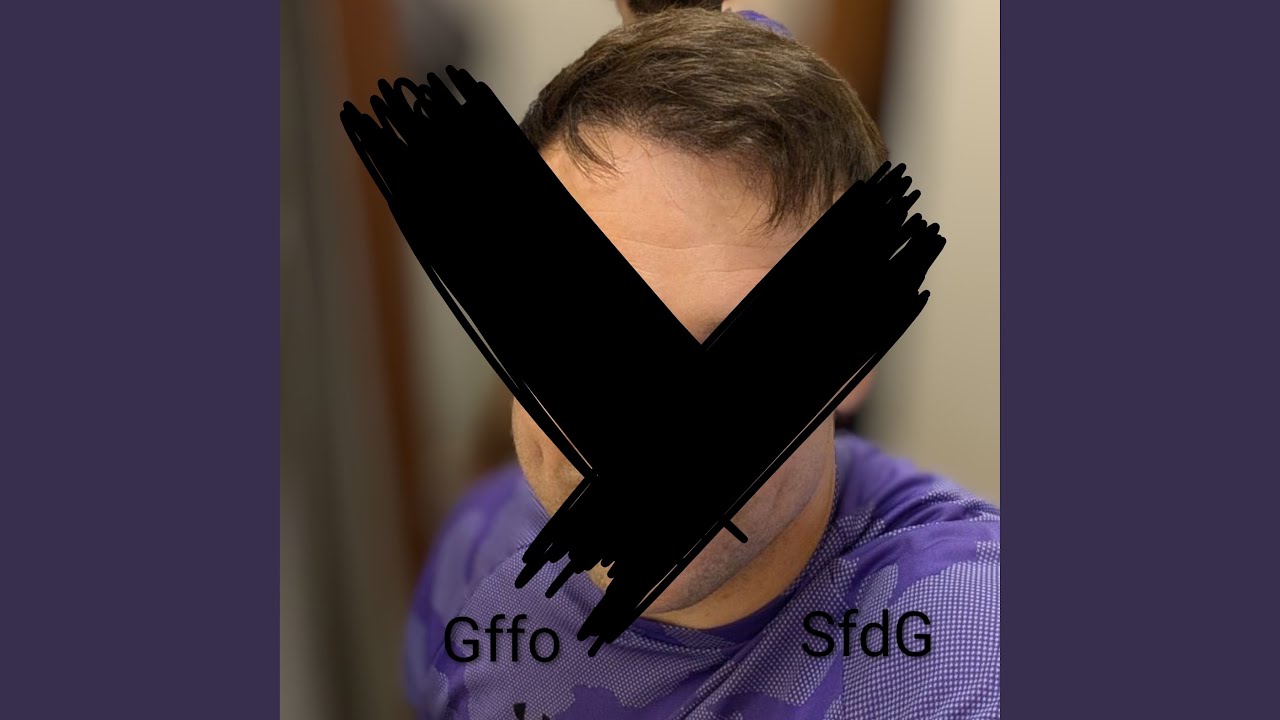 Sfdg auf YouTube ansehen Sfdg auf YouTube ansehen