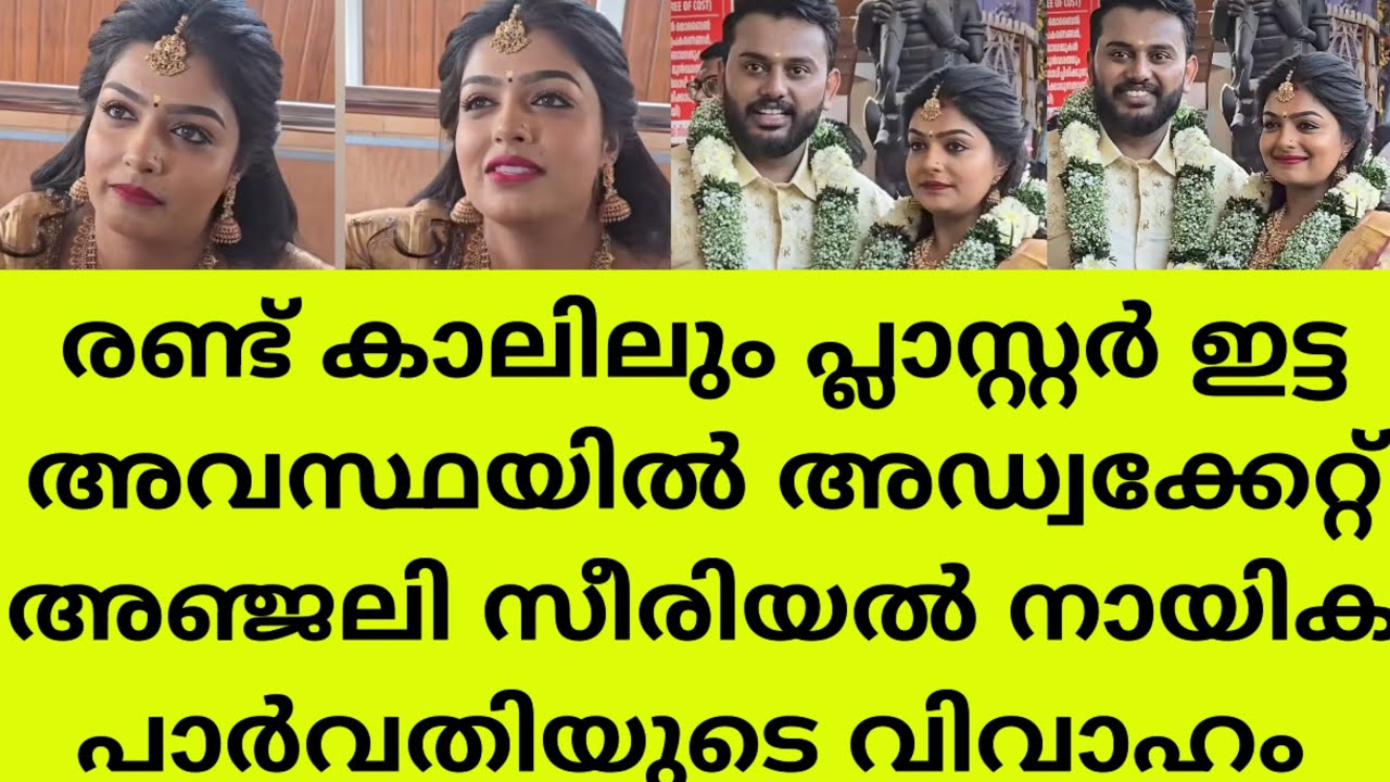 രണ്ടു കാലിലും പ്ലാസ്റ്റർ ഇട്ട് നടി പാർവതി വിവാഹ മണ്ഡപത്തിലെത്തി..actress parvathy wedding video 