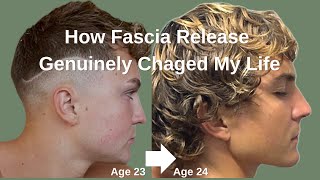 The Fascia Routine That Changed My Face & Life (after puberty)