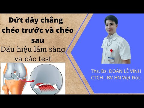Video Đứt dây chằng chéo trước và chéo sau khớp gối: Dấu... - youtube