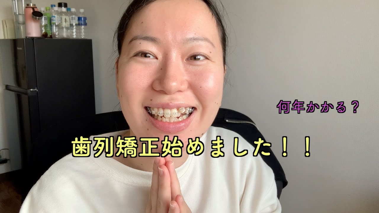 大人歯列矯正始めました！