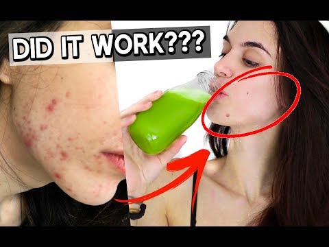 I drank CELERY JUICE for  DAYS to CLEAR my ACNE! This is what happened...