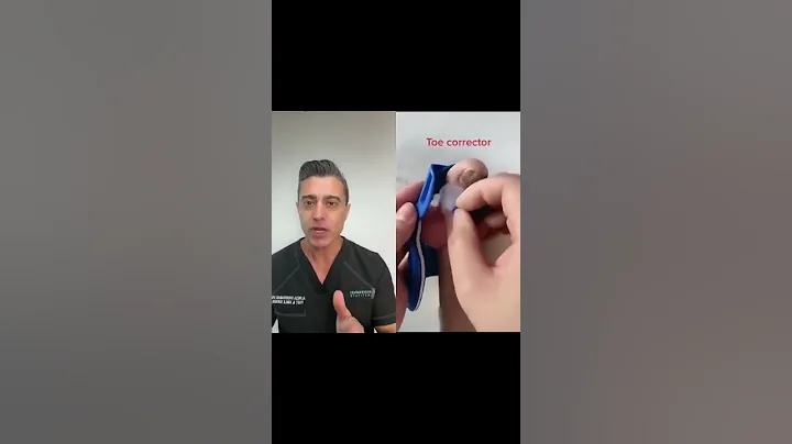 Bunion Corrector! Does it works?