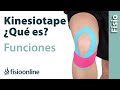 Kinesiotaping o vendaje neuromuscular. ¿Qué es y cómo funciona?