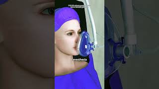 Partial Knee Replacement Surgery (3D Animation)