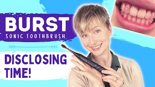 Burst Sonic Toothbrush Review With Disclosing Agent Unsponsored