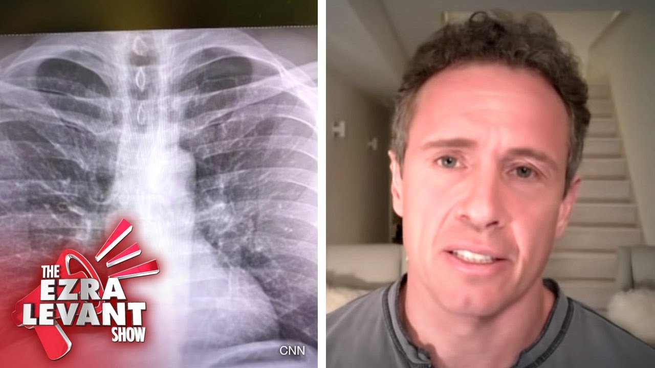 Ezra interviews his father, radiologist Dr. Marvin Levant: Chris Cuomo's coronavirus lung X-ray