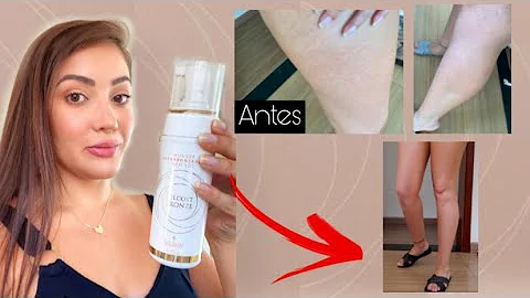 Como usar o autobronzeador nas estrias?