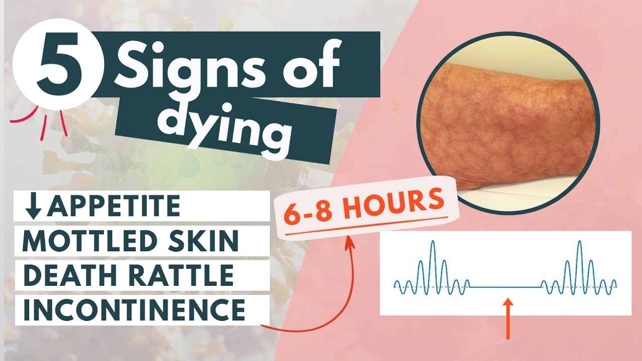 ⁣How to recognize a dying patient? | 5 signs of approaching death