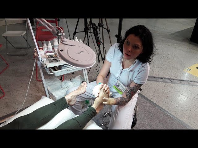 Вопрос про онихолизис. Фрагмент вебинара Варвары Шульц