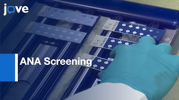 Monospecific and Mixed DFS70 Patterns Distinction during ANA Screening | Protocol Preview