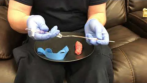 Starting an IV on an umbilical vein