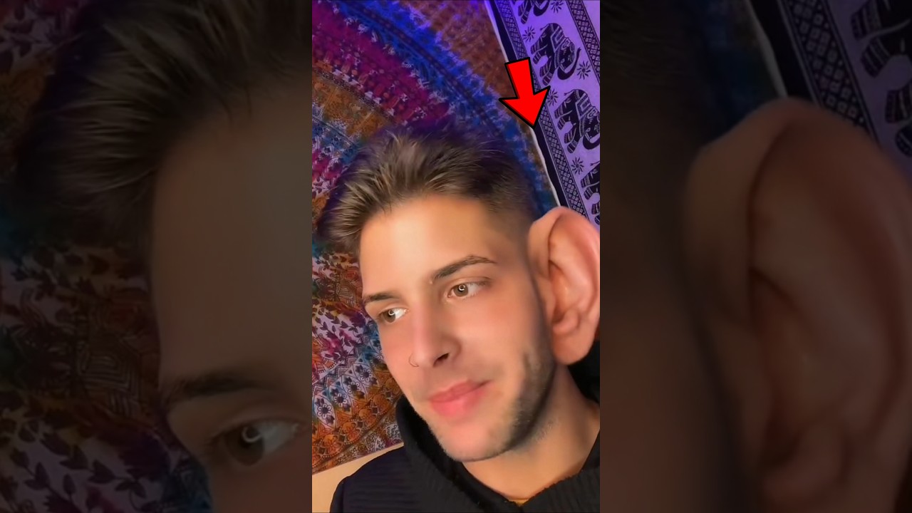 How to Have Smaller Ears 2 Steps 😱 