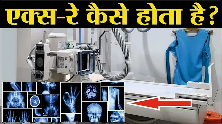 x ray kaise hota hai | x ray test | x ray kya hai