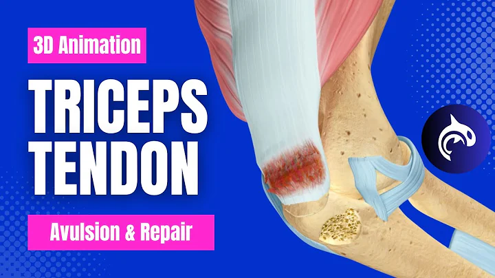 Triceps Tendon Avulsion and Repair - 3D Animation