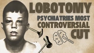 The Shocking Truth About Lobotomies