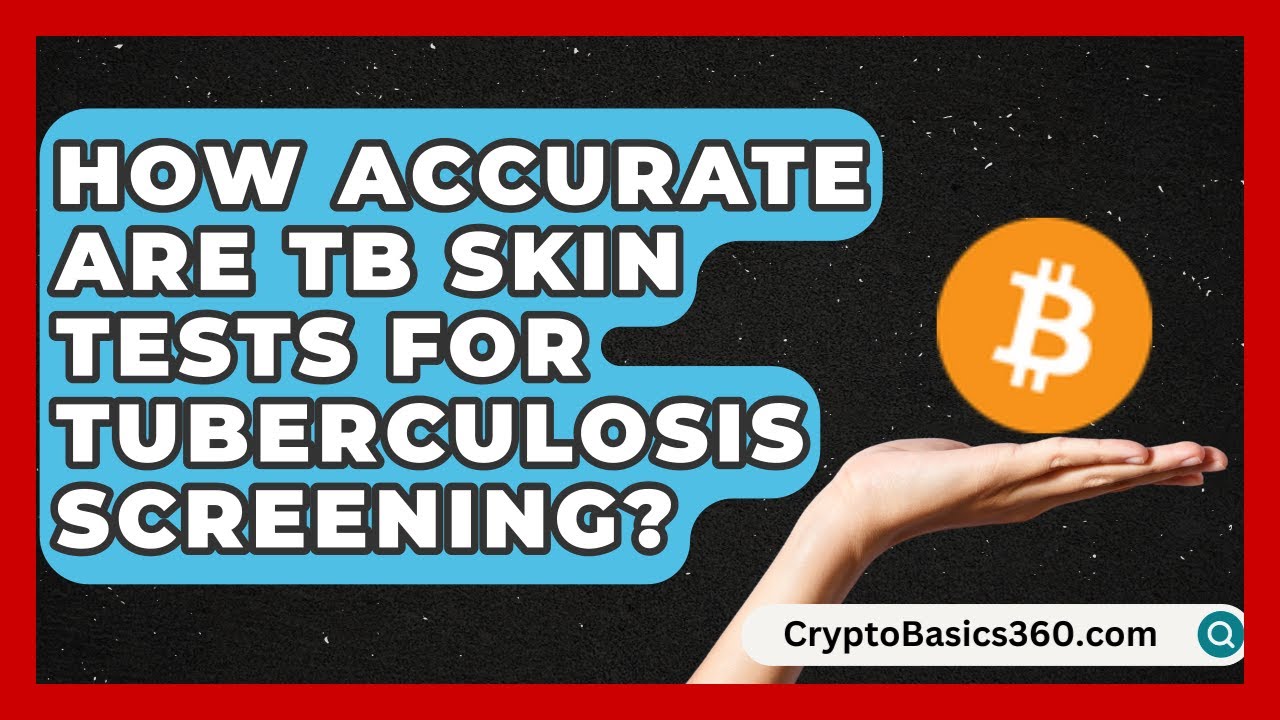 How Accurate Are TB Skin Tests for Tuberculosis Screening ...